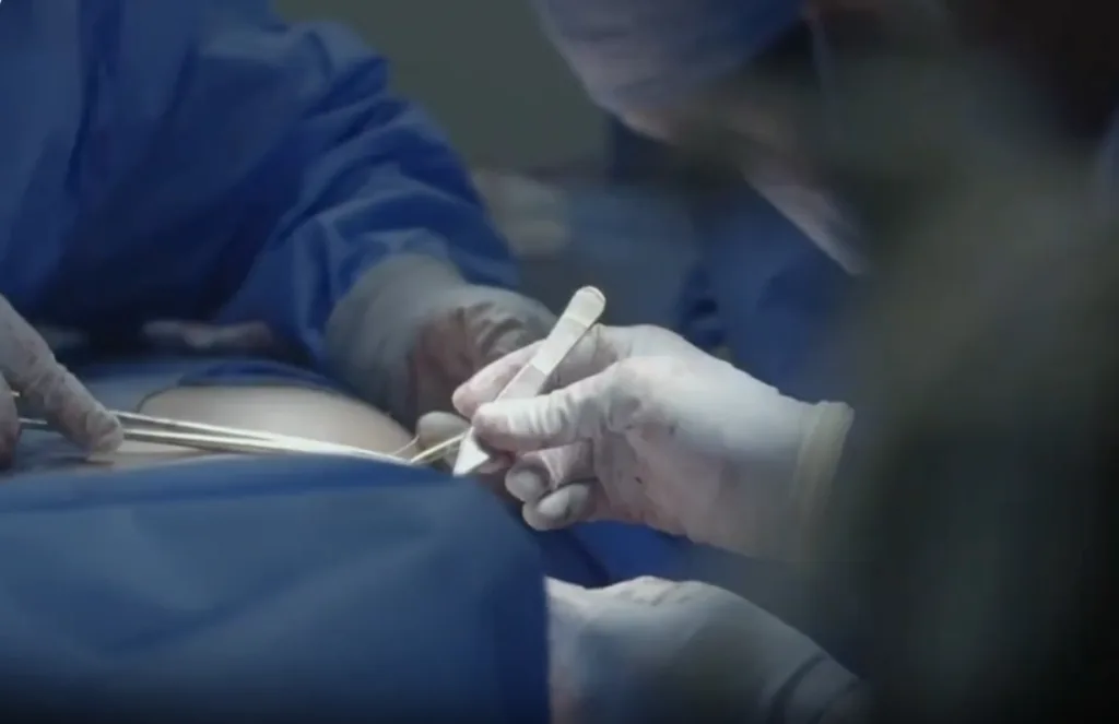 Common Breast Surgeries