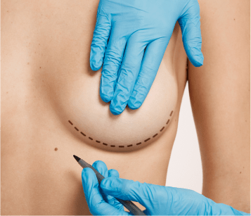 Cosmetic Breast Surgery Procedure