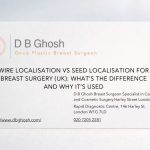 Wire Localisation vs Seed Localisation for Breast Surgery (UK): What’s the Difference and Why It’s Used